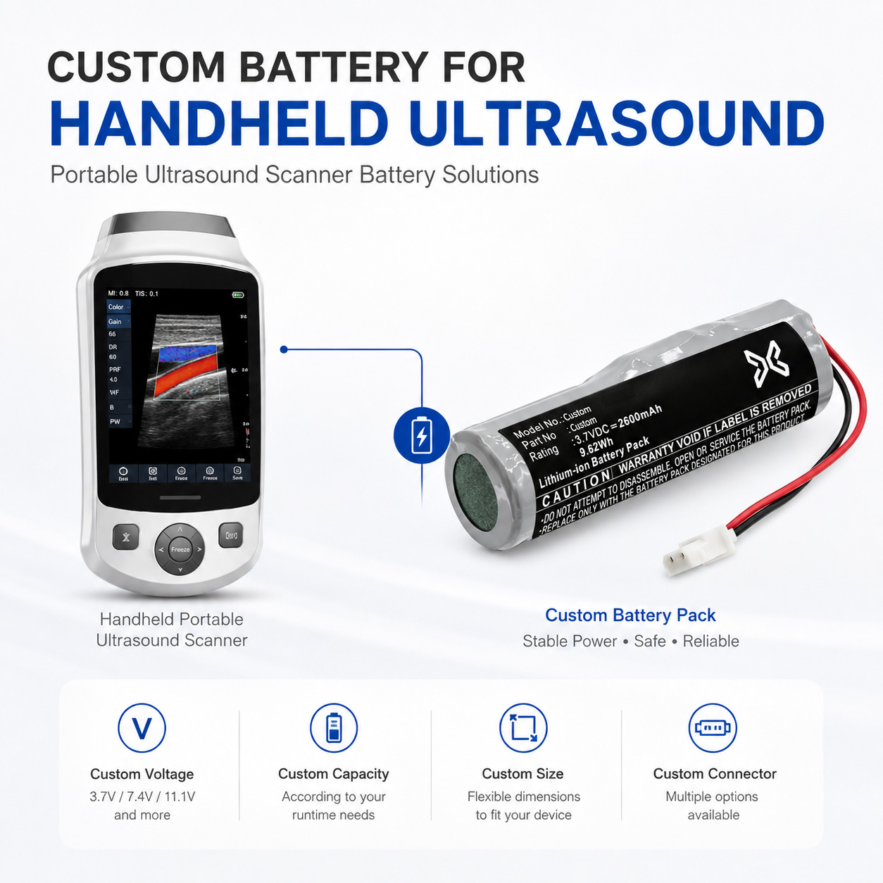 Custom Ultrasound Battery Custom Ultrasound Battery